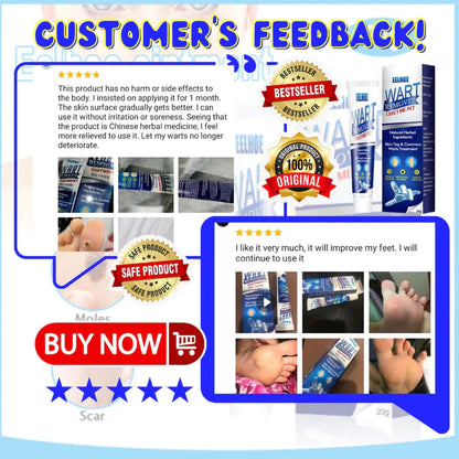 INSTANT WARTS REMOVER CREAM-😍 RATING⭐⭐⭐⭐⭐(4.9/5) 78,564+ CUSTOMERS