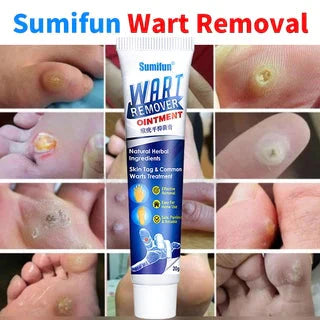 INSTANT WARTS REMOVER CREAM-😍 RATING⭐⭐⭐⭐⭐(4.9/5) 78,564+ CUSTOMERS