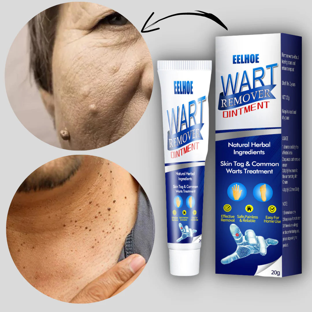 INSTANT WARTS REMOVER CREAM-😍 RATING⭐⭐⭐⭐⭐(4.9/5) 78,564+ CUSTOMERS